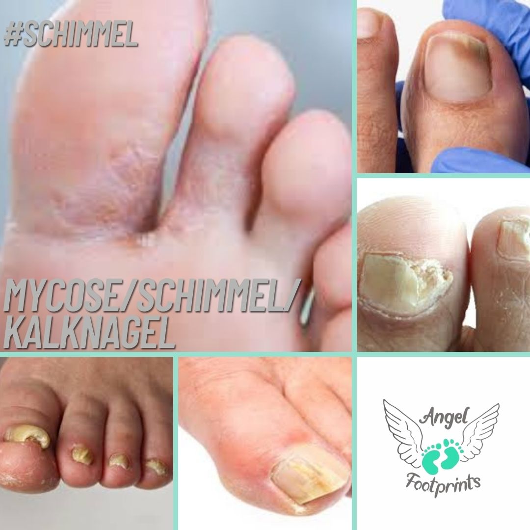 Stap over je schimmelschaamte heet!